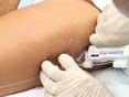 Beautiful: S01E06-Cellulite Treatment In Beverly Hills